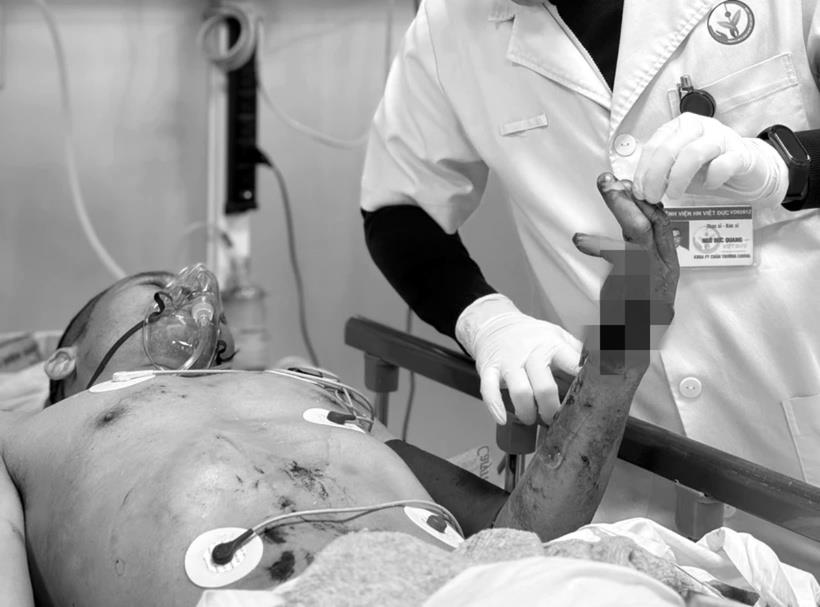 Người đàn ông bị chấn thương quá nghiêm trọng. Ảnh: BSCC