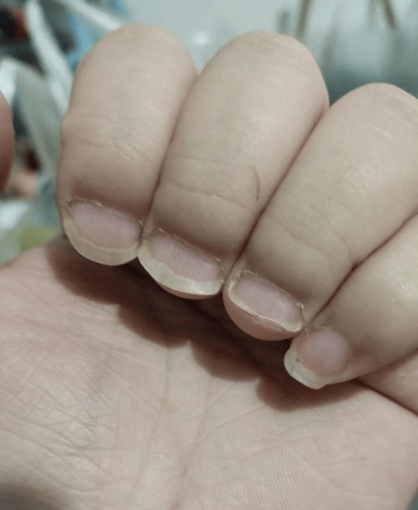 Mẫu nail tự nhiên này có lẽ là "trùm cuối" trong danh sách những mẫu nail độc lạ. Dù chủ nhân rất muốn làm đẹp để đón Tết, nhưng không biết phải làm sao với bộ móng tay có hình dáng đặc biệt của mình.