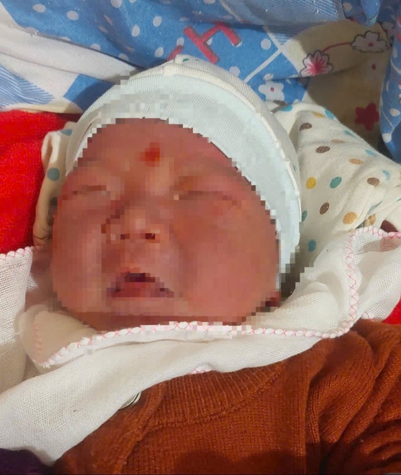 Bé gái sơ sinh bị bỏ rơi được người dân phát hiện. (Ảnh: Tuổi trẻ)