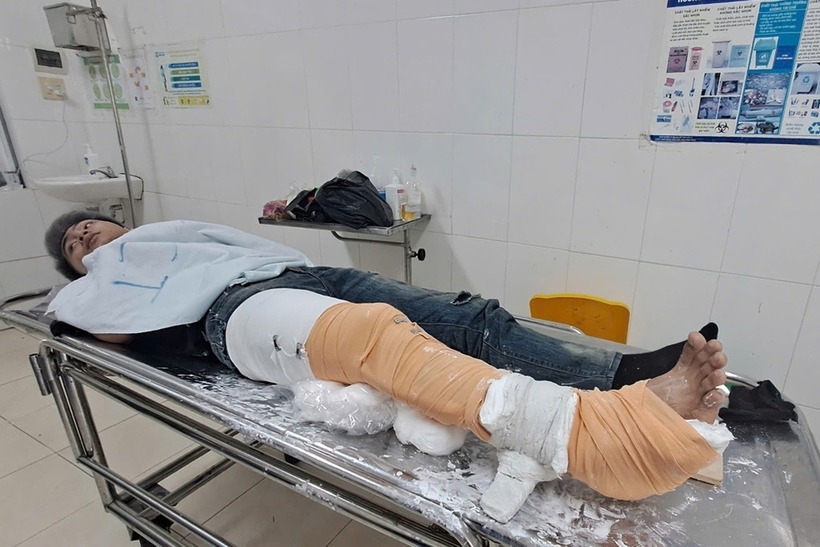 Một nạn nhân bị gãy chân do vụ lật xe khách gây ra được điều trị tại Bệnh viện Đa khoa tỉnh Bình Định. Ảnh: Dân trí