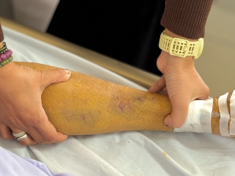 Da người đàn ông vàng như nghệ. Ảnh: Báo Giao Thông