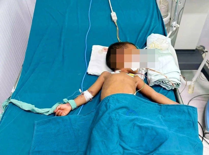 Do không được đưa đi cấp cứu kịp thời, bé Q. bị rối loạn đông máu và xuất huyết não. Hiện bé đang được điều trị tại bệnh viện. Ảnh: Pháp luật TP.HCM.