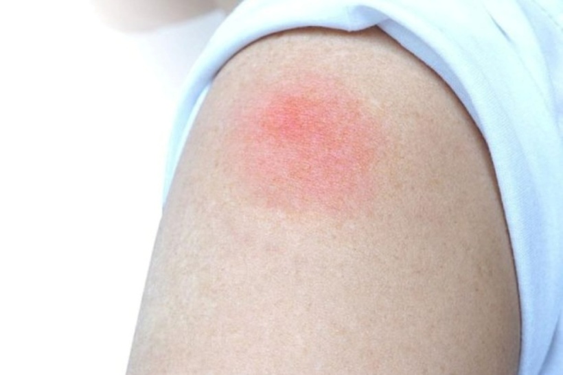 Việc tiêm vaccine cũng có thể dẫn đến một số tác dụng phụ. Ảnh minh họa.