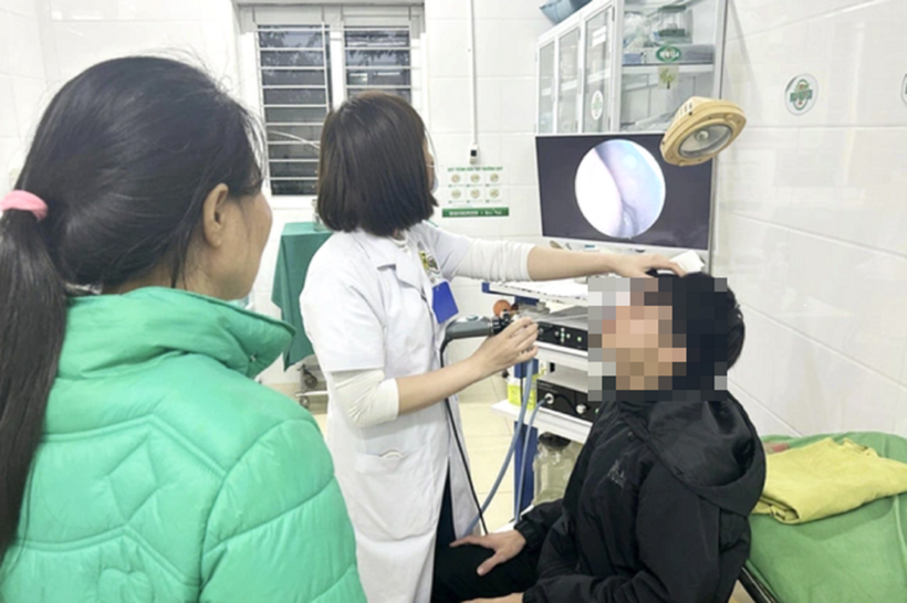 Nam sinh bị người đàn ông hành hung bị gãy xương chính mũi, tổn thương vùng miệng. Ảnh: Tiền phong
