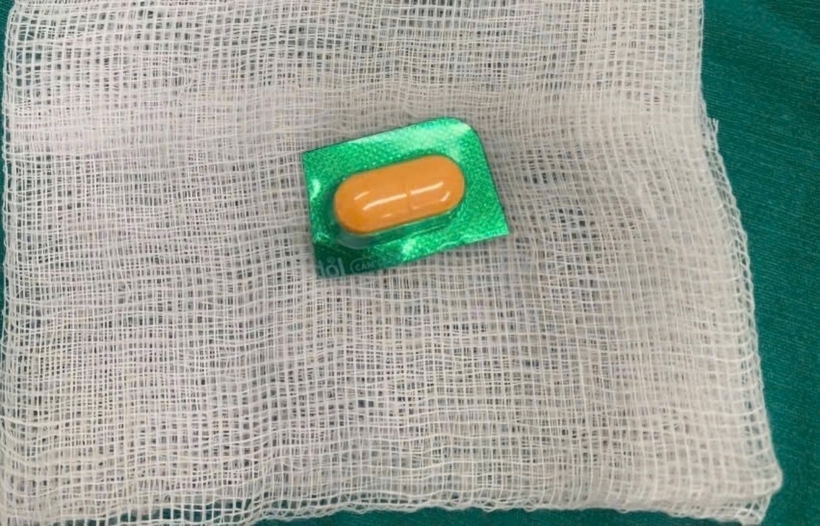 Viên thuốc còn nguyên vỏ với phần cạnh sắc nhọn được lấy ra ngoài. Ảnh: Hà Nội Mới