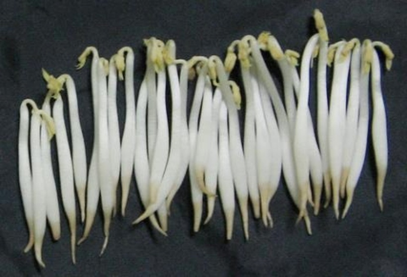 Loại rau đứng đầu danh sách “vua hại gan”, còn ăn đừng trách gan sớm hỏng - 3