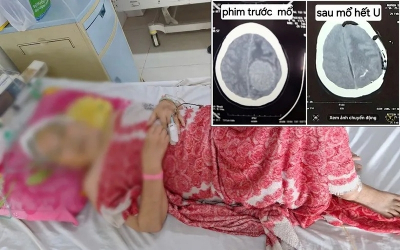 Bệnh nhân đang được tiếp tục theo dõi tại bệnh viện. Ảnh: Thời báo VTV