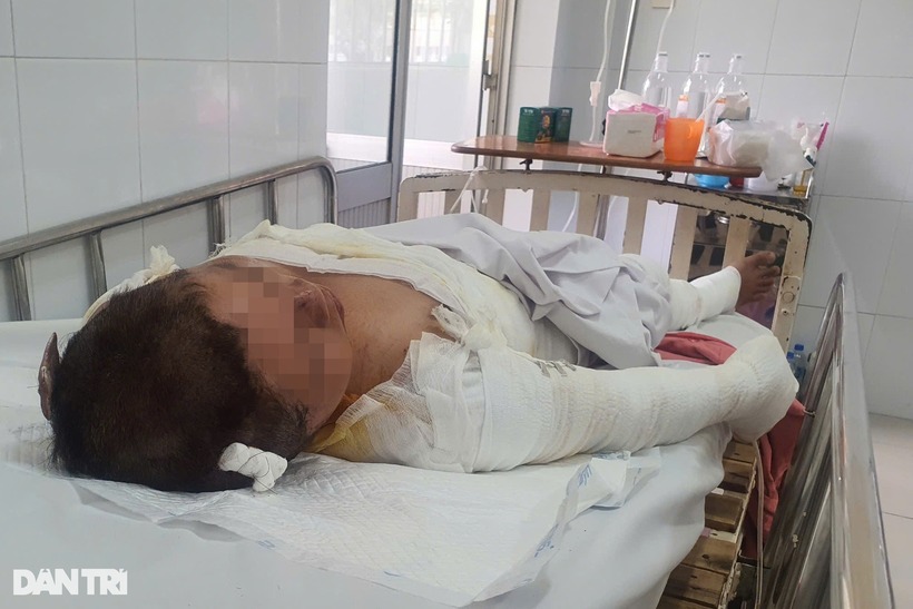 Bà L. tại Bệnh viện Chợ Rẫy. Ảnh: Dân Trí
