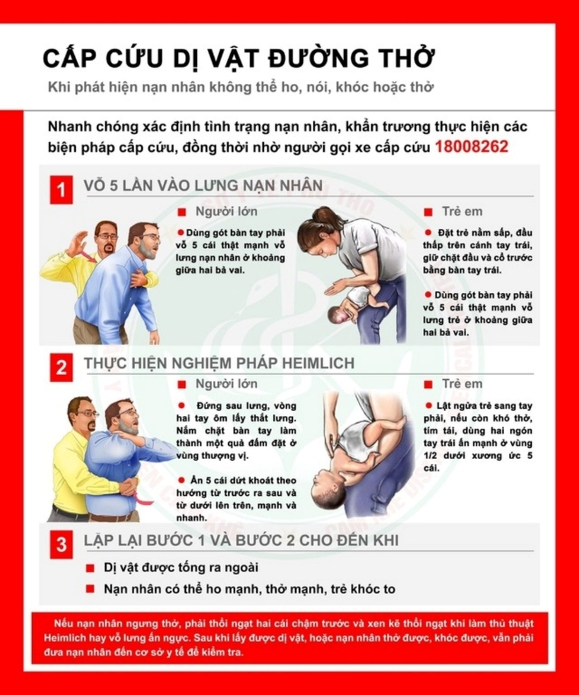 Cách thực hiện thủ thuật Heimlich đúng. Ảnh: Người Lao Động