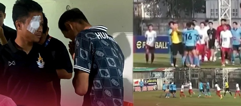 Cầu thủ Srithai Bookok bị Songkran đấm bị thương khá nặng ở mắt và phải phẫu thuật. Ảnh: Siam Sports.