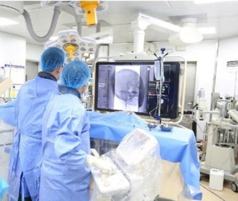 Bác sĩ can thiệp lấy huyết khối cho người bệnh. Ảnh: Tạp chí Tri Thức.