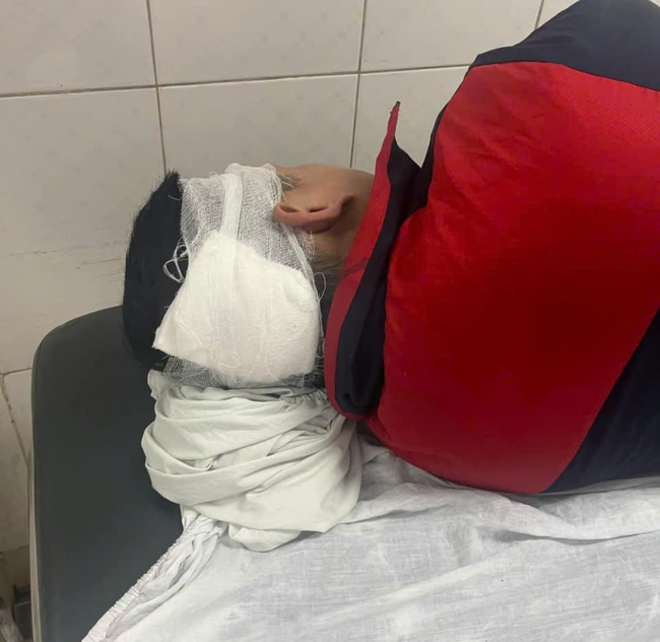 Nạn nhân đang điều trị tại bệnh viện 19-8.