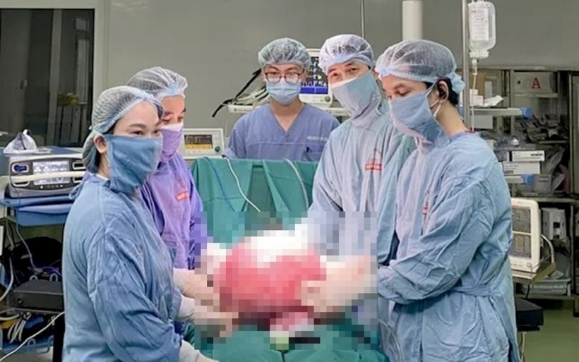 Người phụ nữ mang khối u nặng tới 15kg. Ảnh: Thời báo VTV