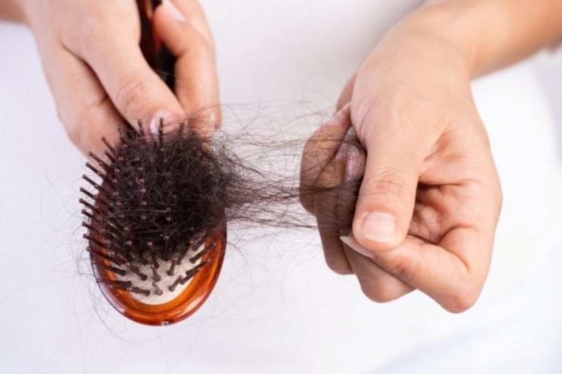 Không có mối liên hệ trực tiếp nào giữa tình trạng rụng tóc với tần suất gội đầu. Ảnh minh họa