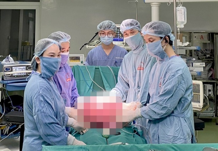 Sau khoảng 3 giờ phẫu thuật, các bác sĩ đã thành công lấy khối u khổng lồ nặng 15kg ra khỏi bụng người bệnh. Ảnh: BVCC.