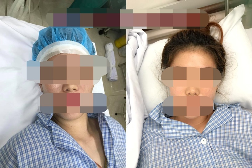 Nỗi lo "gò má cao sát chồng" từ quan niệm dân gian thúc đẩy nhiều phụ nữ tìm đến thẩm mỹ viện, mong đổi vận mệnh. Ảnh minh họa.