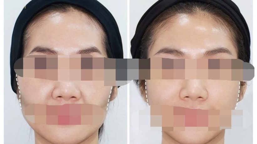 Theo phong thủy, tướng mạo dù thay đổi cũng không cải biến được vận mệnh, gương mặt vẫn biến đổi theo thời gian; dù phẫu thuật nhiều, tướng vẫn thay đổi theo tâm, tâm xấu tướng xấu, tâm thiện tướng thiện. Ảnh minh họa.