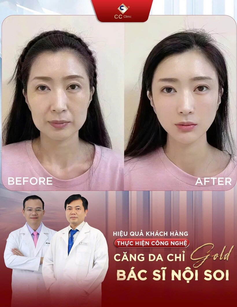 Hiệu quả vượt trội khi thực hiện phương pháp làm đẹp tại thẩm mỹ CC