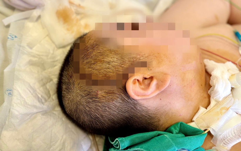 Ngoài tình trạng tổn thương cấp tính, thể trạng béo phì của bệnh nhân (nặng hơn 100kg) cũng là một yếu tố nguy cơ lớn đối với các bệnh lý mạch máu não. Ảnh: BVCC
