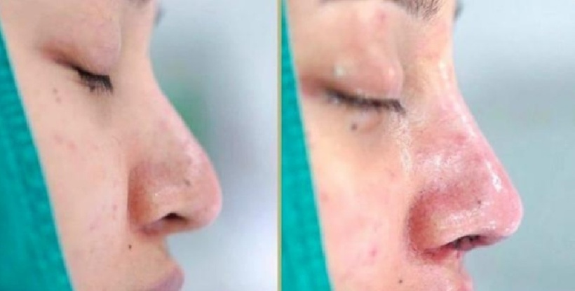 Tin lời thầy "sửa mũi" để đổi vận, người phụ nữ nhận trái đắng nợ nần. Ảnh minh họa.