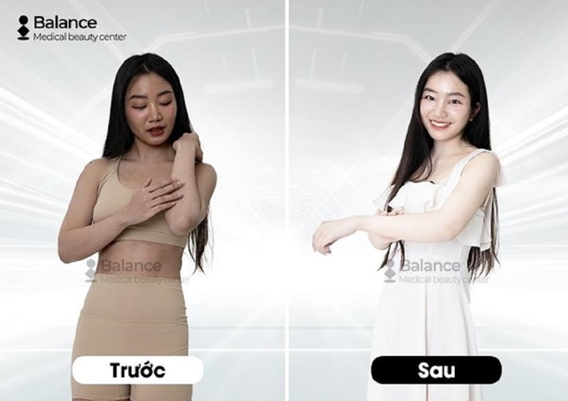 Kết quả trước – sau của khách hàng