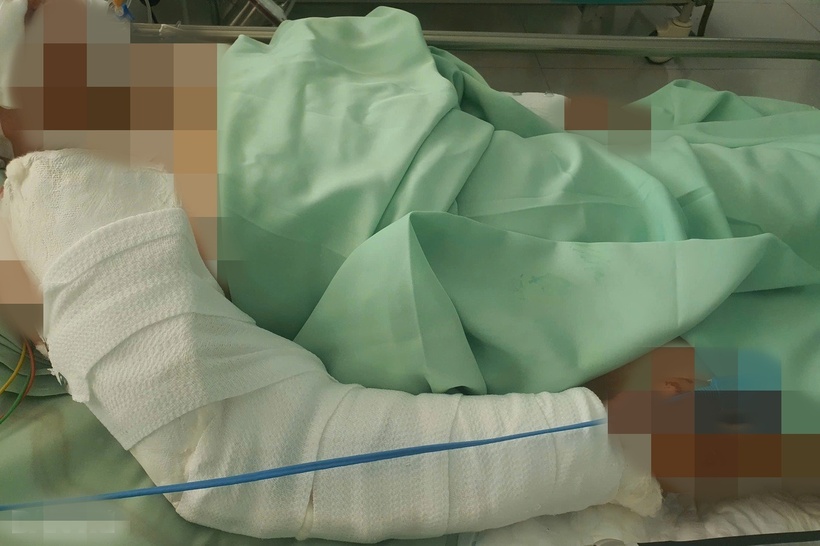 Chị M.H. trải qua ca phẫu thuật kéo dài 5 giờ. Ảnh: Dân Trí.