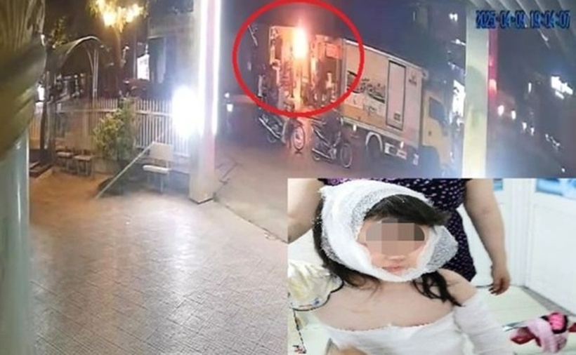 Hiện trường vụ phóng hỏa được camera ghi lại và hình ảnh bé gái đang điều trị tại bệnh viện. (Ảnh: Tiền phong)