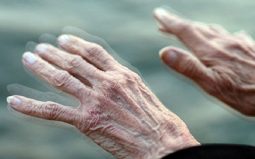 Càng cố chữa thì tình trạng run do Parkinson của ông Dương càng nặng hơn