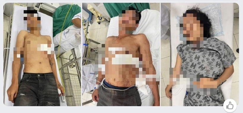 Thanh niên đâm trọng thương 3 người nhà bạn gái trong cuộc nhậu.