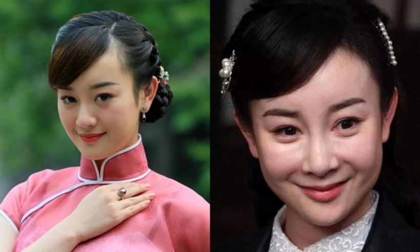 Nữ diễn viên cảm thấy hối tiếc vì đã phẫu thuật thẩm mỹ. Ảnh: Sina