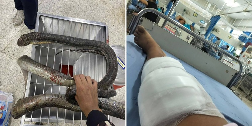 Người phụ nữ bị rắn hổ mang chúa cắn vẫn tay không "xử đẹp" con vật rồi mang đến bệnh viện. Ảnh: Mush Share News