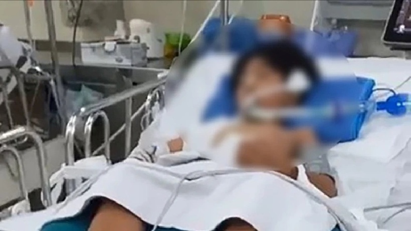 Bệnh nhi hiện phải thở máy, được phối hợp nhiều biện pháp điều trị nội khoa. Ảnh: PLO.