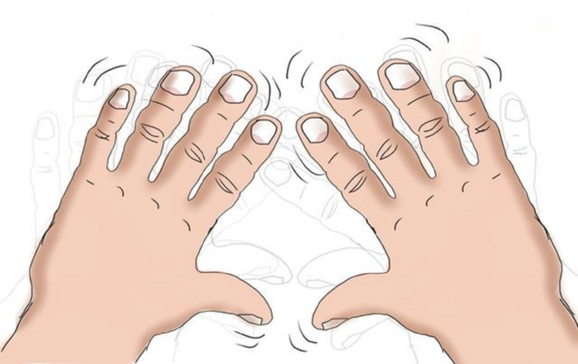 Nhiều trường hợp run tay chân không rõ nguyên nhân gây bệnh.