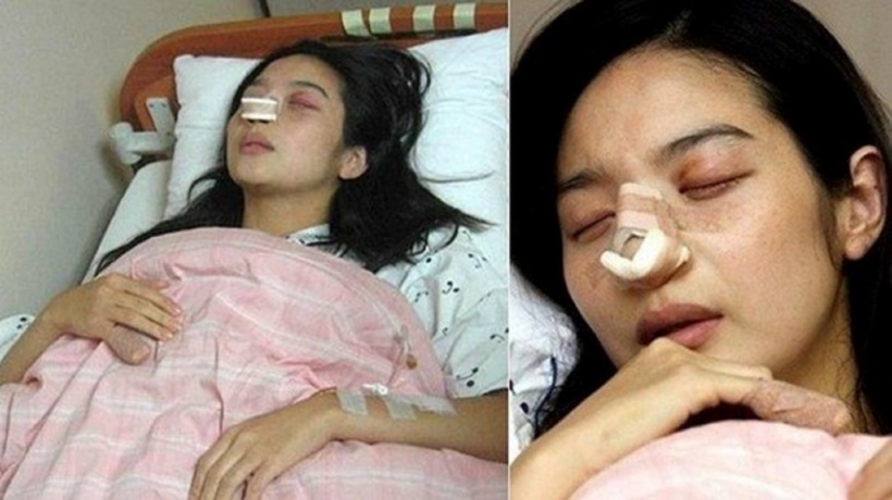 Lee Min Young trên giường bệnh vào năm 2006, sau khi bị Lee Chan hành hung đến mức sảy thai.
