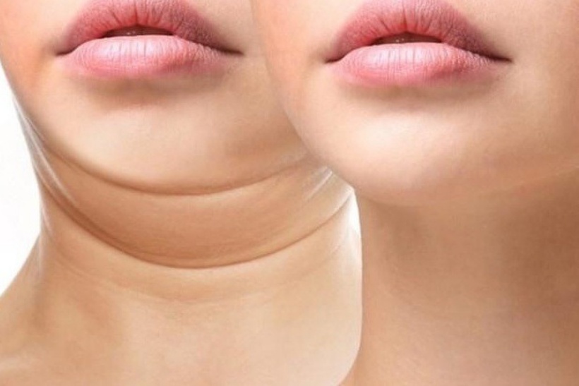 Mỗi người dân cần biết nhận thức, tỉnh táo đến cơ sở làm đẹp có chuyên môn, cũng như tìm hiểu kỹ để tránh tiền mất, tật mang. Ảnh minh hoạ.