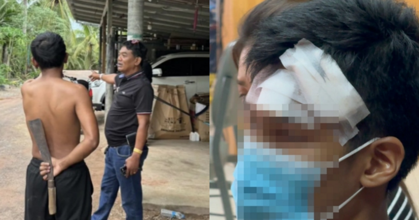 Nam shipper ở Thái Lan bị chồng của khách hàng dùng dao tấn công. Ảnh: Mush Share News