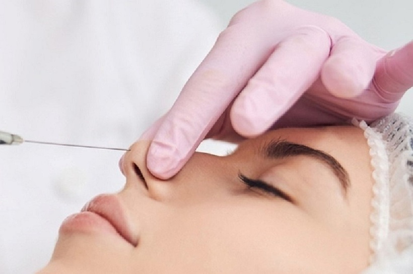 Nâng mũi bằng chỉ thực chất là phương pháp thẩm mỹ an toàn, tuy nhiên cần được thăm khám và thực hiện bởi Bác sĩ có tay nghề. Ảnh minh họa.