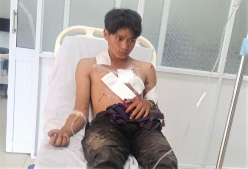 Thuật, một trong hai người bị nạn trong vụ nổ, hiện đang được điều trị tại bệnh viện. Ảnh: Công an nhân dân.