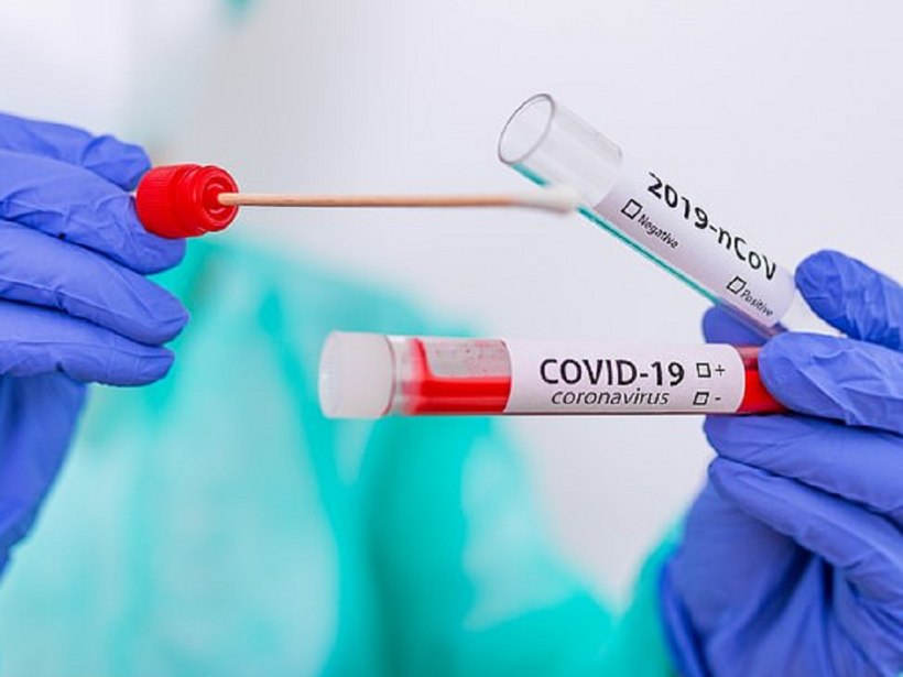 Hà Nội ghi nhận 23 ca mắc Covid-19 mới trong tuần. Ảnh minh họa