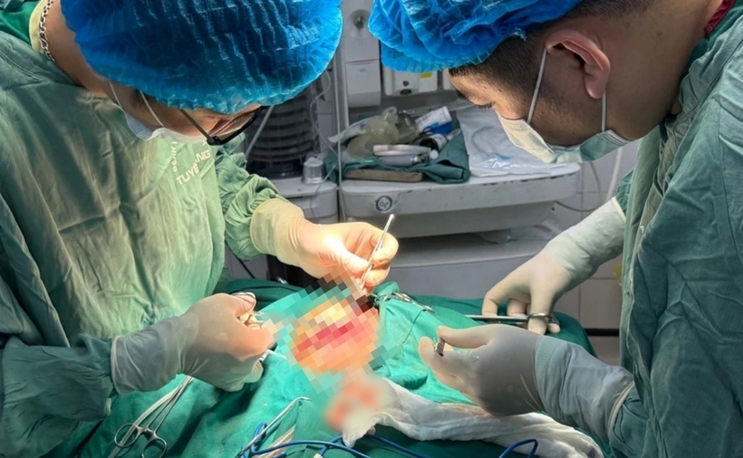 Các bác sĩ tiến hành phẫu thuật cho bệnh nhi. Ảnh: Giáo Dục và Thời Đại