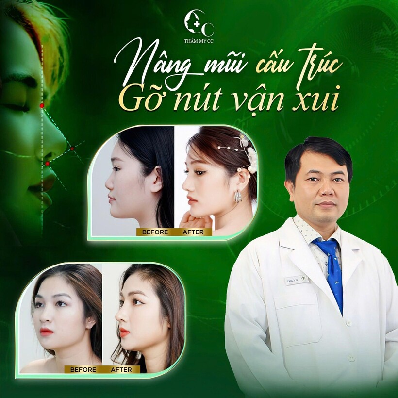 Thẩm Mỹ C.C tái tạo dáng mũi hài hòa – Tăng vẻ đẹp, nâng tầm diện mạo - 3