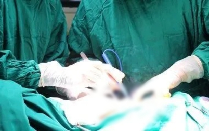 Các bác sĩ tiến hành phẫu thuật. Ảnh minh họa: Thời báo VTV
