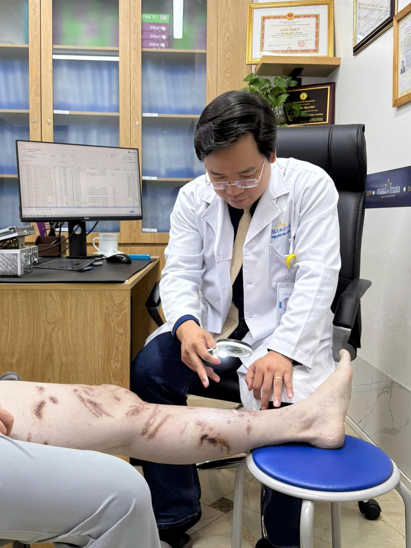 Một trong những sai lầm phổ biến mà nhiều người mắc phải khi bị sứa chích là rửa vết thương bằng nước ngọt, chà xát hoặc dùng đá lạnh. Ảnh: BSCC