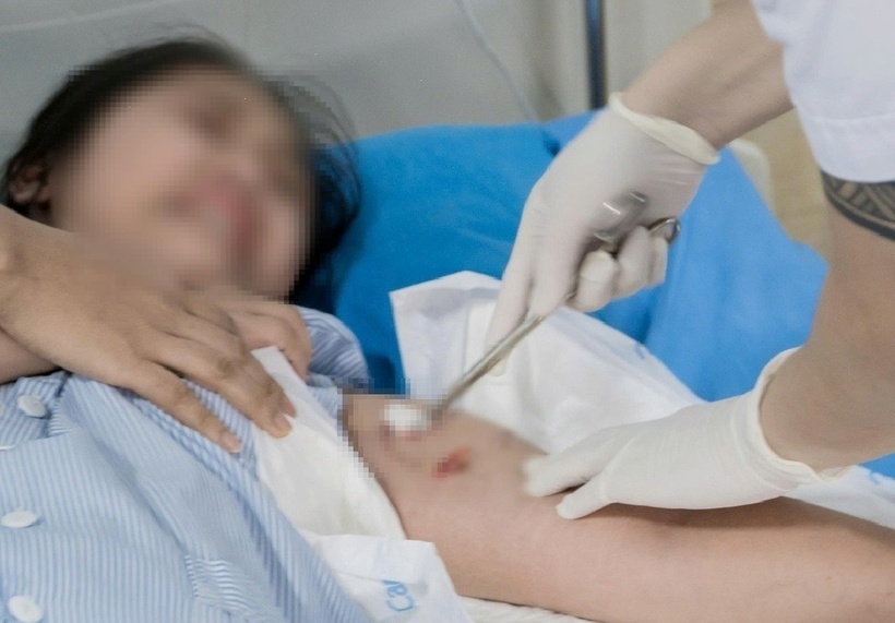 Bị chó nhà hàng xóm cắn, bé gái nhập viện với nhiều vết thương. Ảnh: Tạp chí Tri thức.