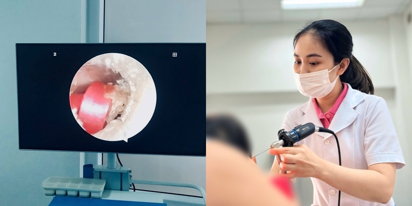 Bé gái 6 tuổi suýt thủng màng nhĩ vì... một sợi dây buộc tóc