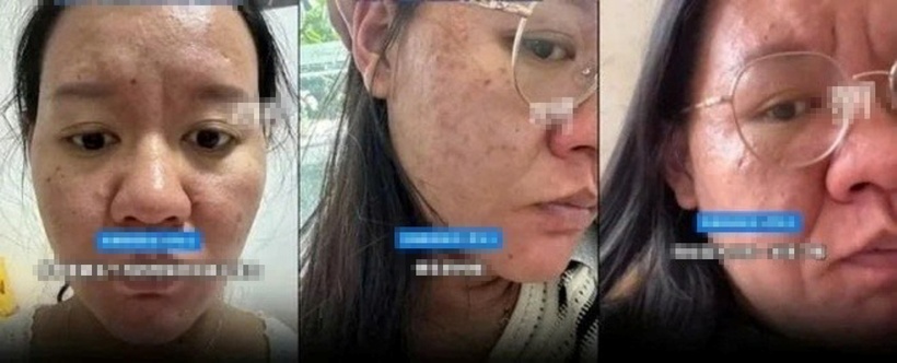 Mặc dù Li đã được các bác sĩ trấn an rằng những thay đổi này là hoàn toàn tự nhiên và không quá nghiêm trọng, song cô vẫn rất hoang mang. Ảnh: O.C