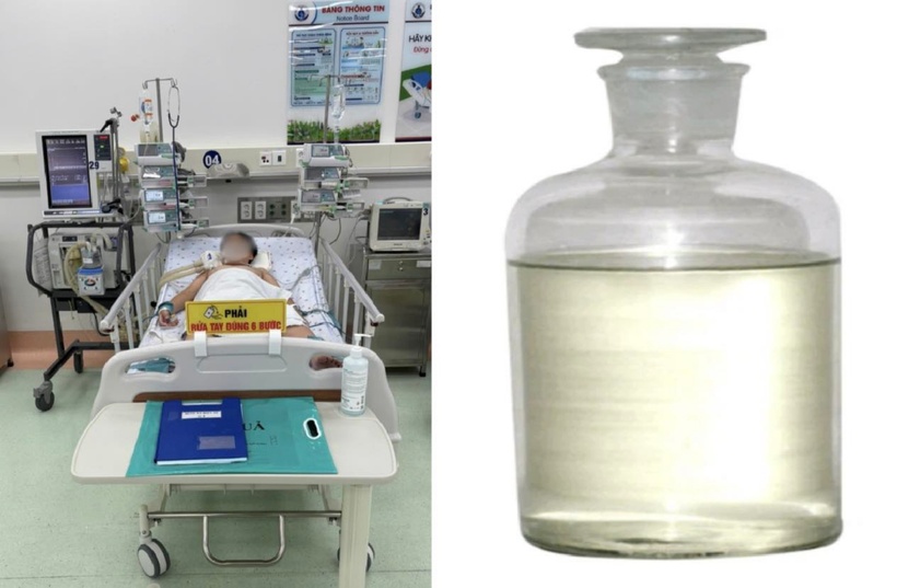 Bé trai đột ngột hôn mê, suy hô hấp nặng do ngộ độc khí độc khi ngồi trong xe hơi. Ảnh: BVCC