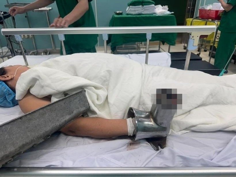 Bà N. nhập viện trong tình trạng đau đớn dữ dội, chảy máu nhiều, bàn tay mắc kẹt trong máy xay thịt. Ảnh: Vietnamnet.