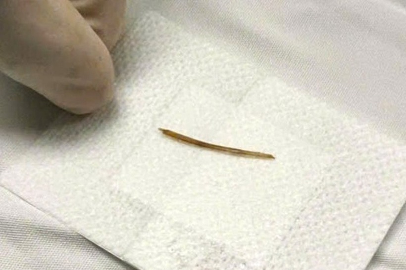 Xương cá dài khoảng 4cm. Ảnh: Báo Dân trí.