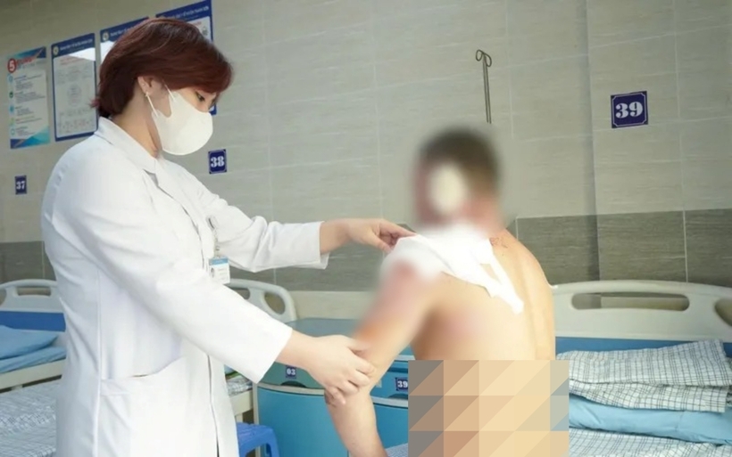 Sức khỏe người bệnh dần ổn định, vết bỏng đang khô dần, dự kiến có thể xuất viện trong vài ngày tới. Ảnh: Thời báo VTV